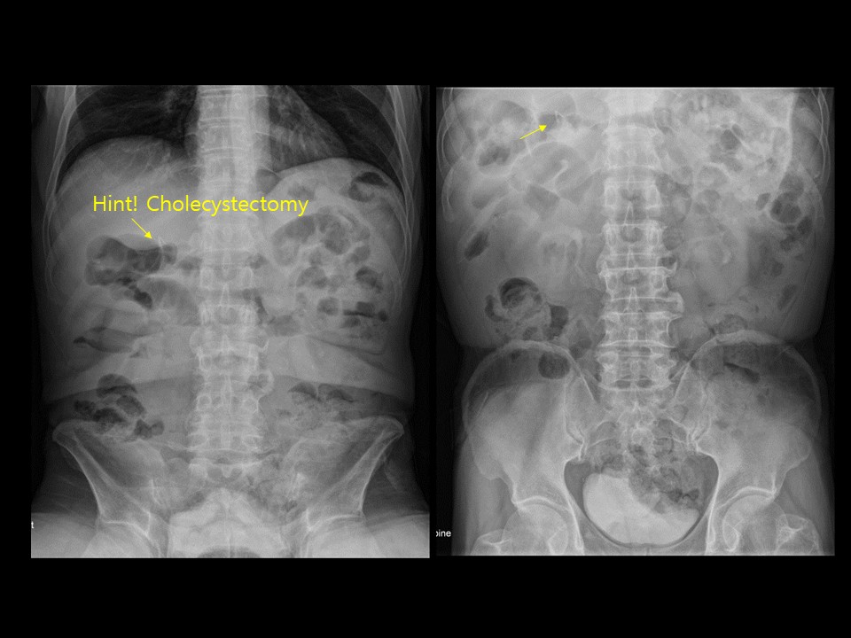 The Korean Society of Abdominal Radiology